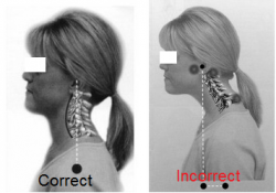 incorrect neck alignment
